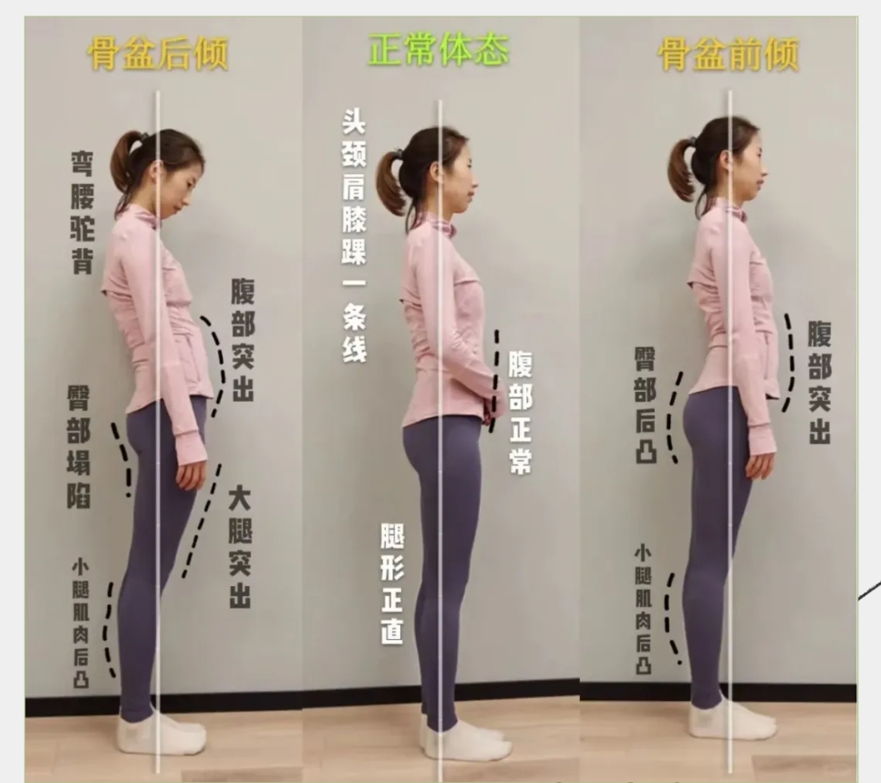 为什么越来越多的女性，产后都开始做骨盆修复？